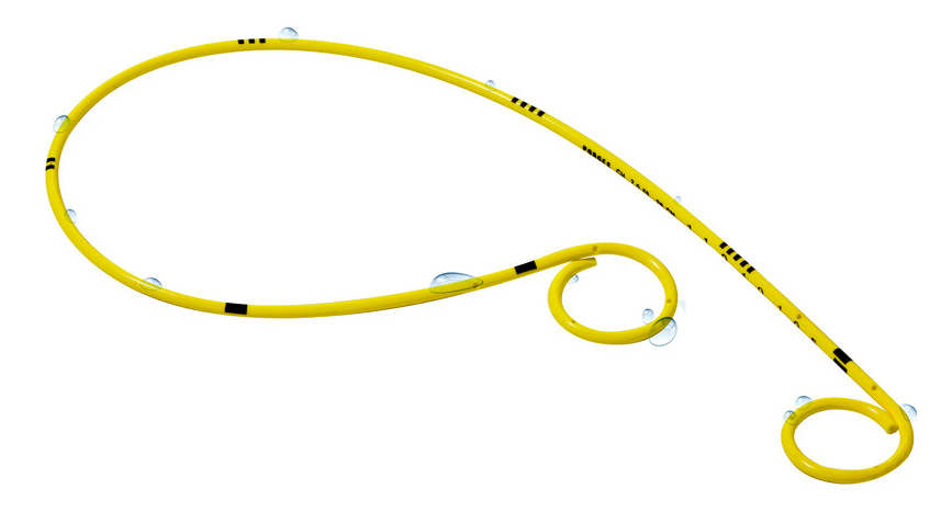 jj-stent-pri-mochetochnikovoy-bolezni.jpg